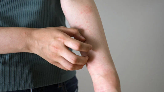 Struggled with candida overgrowth, frequent UTI and skin issues