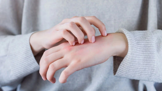 Unknown skin problems and low immune function due to poor gut health